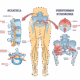 Active Life Chiropractic Sciatica Diagram